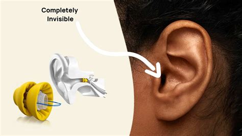 Best Tinnitus Masking Hearing Aids And Sound Machines In 2023