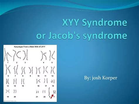 Ppt Xyy Syndrome Or Jacobs Syndrome Powerpoint Presentation Free Download Id6730690