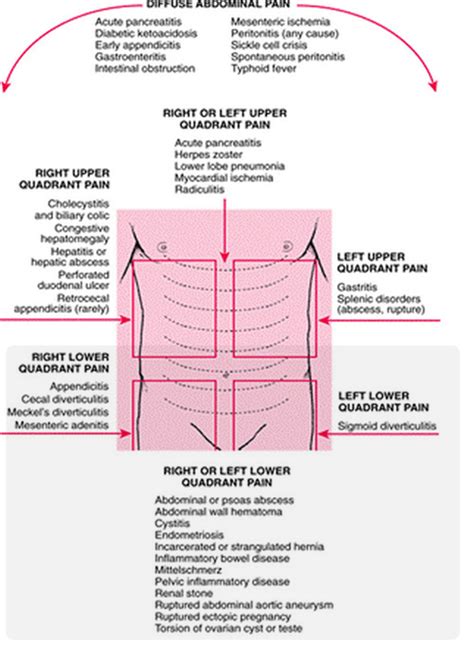 Severe Lower Abdominal Pain