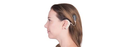 Best Cochlear Implant Centers