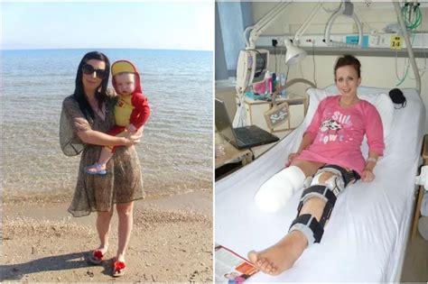 A Holidaymaker Who Had To Have Her Leg Amputated Has Been Handed A