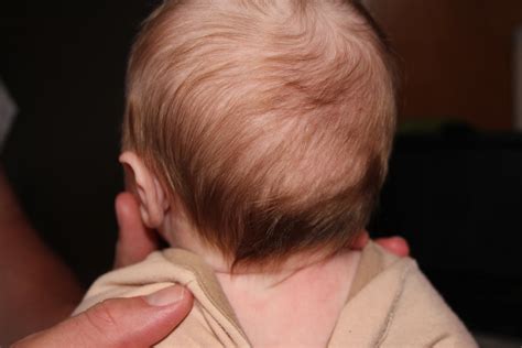 Dear Person Reading This Baby Bald Spot