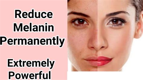 Reduce Melanin Permanently Skin Lightening Permanently Using Binaural