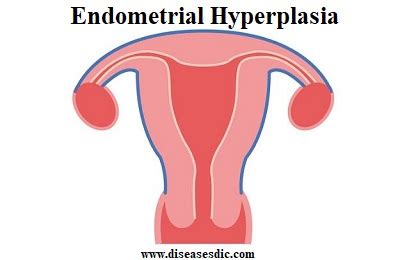 Understanding The Thickening Of The Uterine Lining After Menopause
