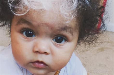 Baby Takes After Generations Of Women To Be Born With Streak Of White