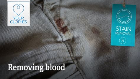 Stain Removal How To Remove Blood Stains From Clothes Youtube