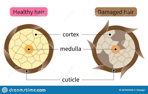 Layer Of Healthy And Damaged Hair Structure The Hair Shaft Consists Of