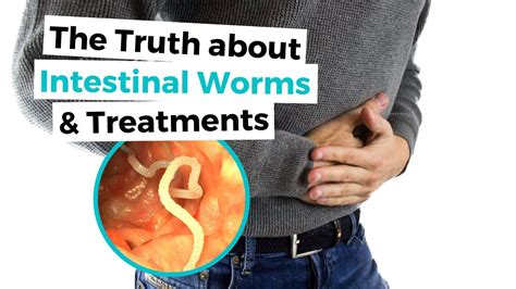 Get Rid Of Intestinal Worms Au Naturale Symptoms Treatment Causes Youtube