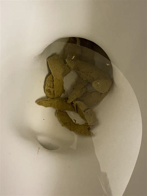 Poop Ecosia Images