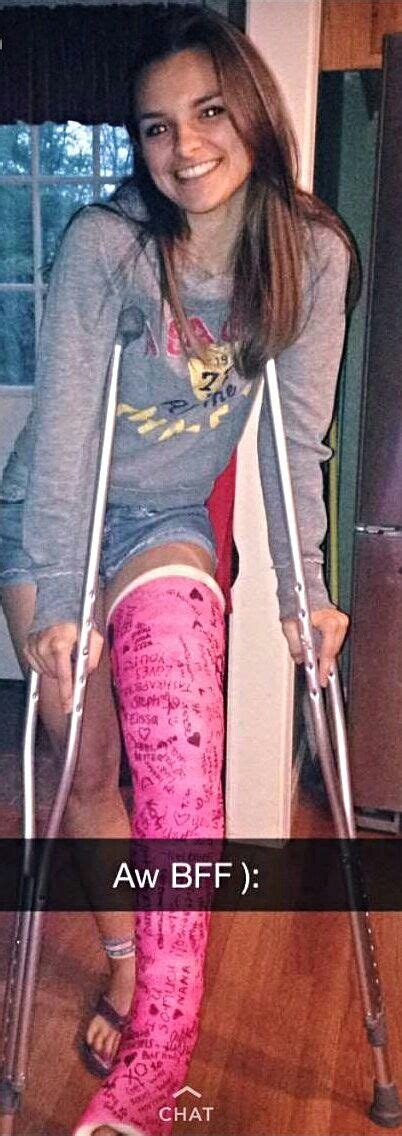 Pin By Shelly Smith On Crutches Long Leg Cast Leg Cast It Cast
