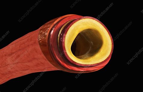 Sectioned Blood Vessel Stock Image C0079927 Science Photo Library