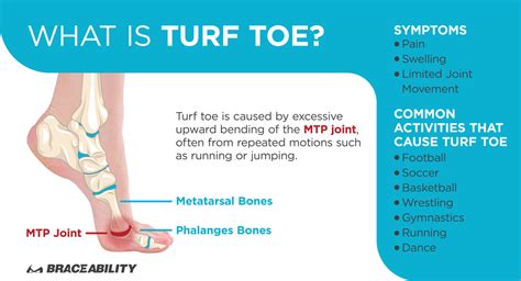 Even though it is not considered a serious injury it can be very debilitating and take a long. Turf Toe Brace | This Soft Splint Works Better than Taping
