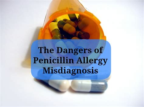 Penicillin Allergy Most Common And Inaccurate Drug Allergy