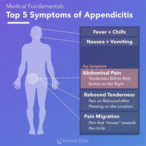 Top 5 Symptoms Of Appendicitis Appendicitis Symptoms Medical