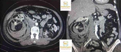 Radiology Board Review Cases Spotters Set Radiogyan Radiogyan