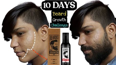Beardo Hair Growth Oil After 10 Days Review Best Beard Oil For Patchy