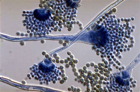 Pollen or dust allergy is a nasty thing. Aspergillus flavus under microscope | Medical Laboratories