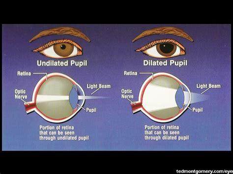 Pupillary Dilator Meddic