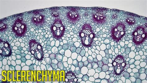 Sclerenchyma Under Microscope