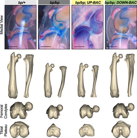 Morphological Appearance Of Femur Tibia And Knee Joint Structures In