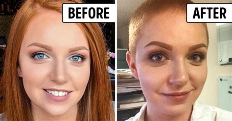 before and after shaved women telegraph