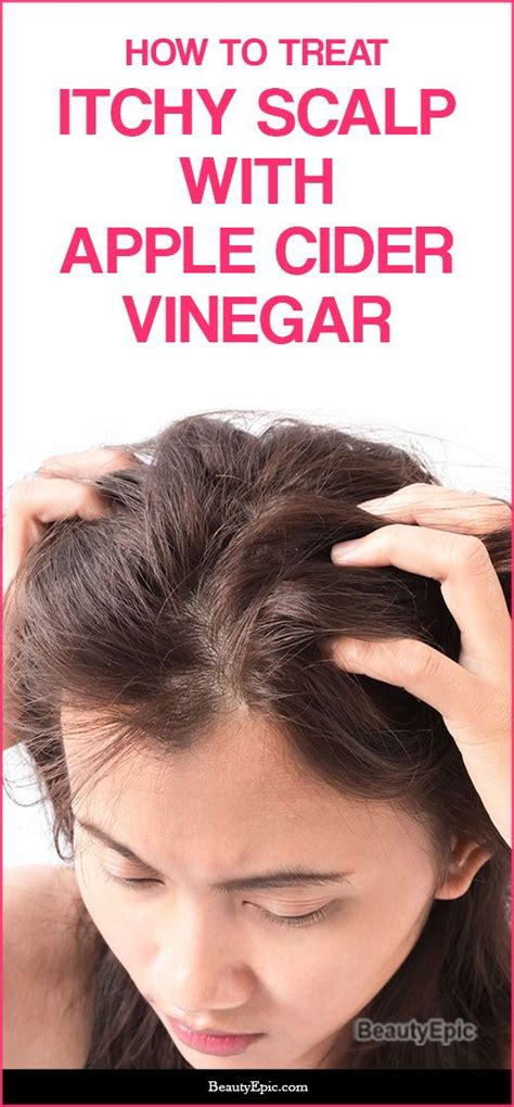 How To Use Apple Cider Vinegar For Itchy Scalp And Dandruff Relief
