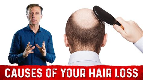 The Underlying Root Cause Of Hair Loss Treatment For Hair Loss Dr Berg YouTube