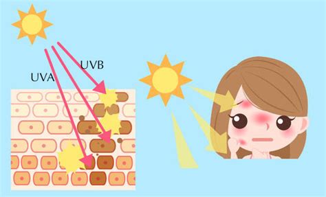 Cara hilangkan sunburn dengan cepat dan berkesan. Cara Hilangkan Sunburn Di Muka Dengan Pelembab ...