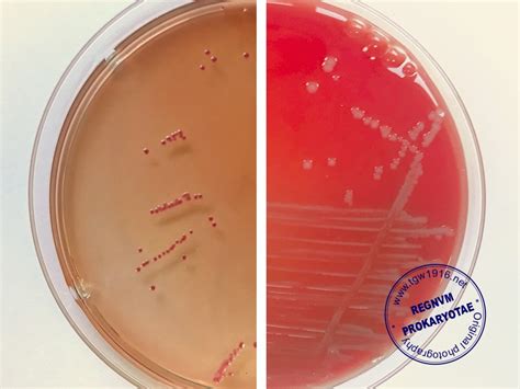 Enterococcus Faecalis Macconkey Agar