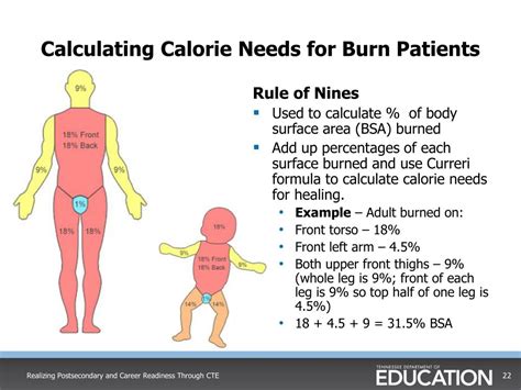 In this article we look back at how the treatment of burns has evolved over the centuries from a primarily topical therapy consisting of weird and wonderful topical concoctions in ancient times to one that spans multiple scientific fields of topical therapy, antibiotics, fluid resuscitation, skin excision. PPT - Nutrition and Diet Therapy Course Standards Dina ...