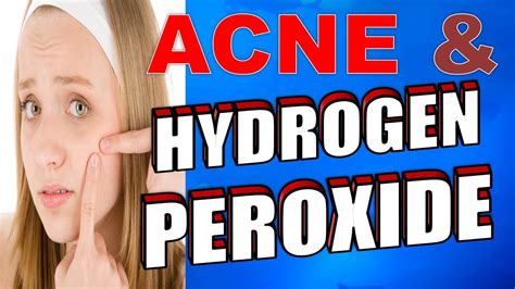 6 simple steps for using hydrogen peroxide for acne youtube
