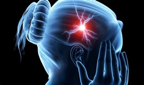 moždani udar simptomi zdravlje Informer rs