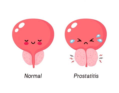 Premium Vector Normal Prostate And Benign Prostatic Hyperplasia Cute Smiling Happy And Sick