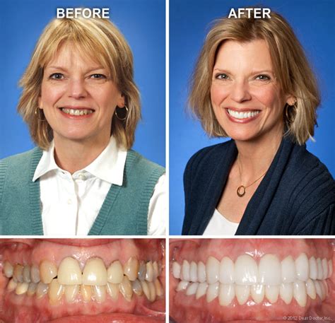 Cosmetic Dentistry Floss Seattle