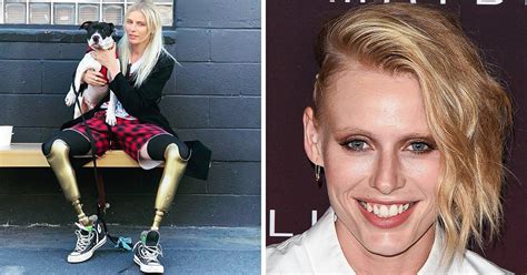 How Lauren Wasser Lost Her Legs Due To Tampon Use But Found Strength To