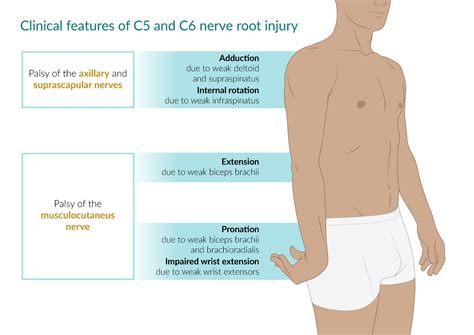 Axillary Nerve Damage