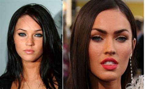 Megan Fox Plastic Surgery Horror Picture Gallery Megan Fox Before