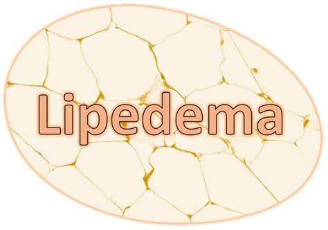 Lipedema Vs Lymphedema Whats The Difference