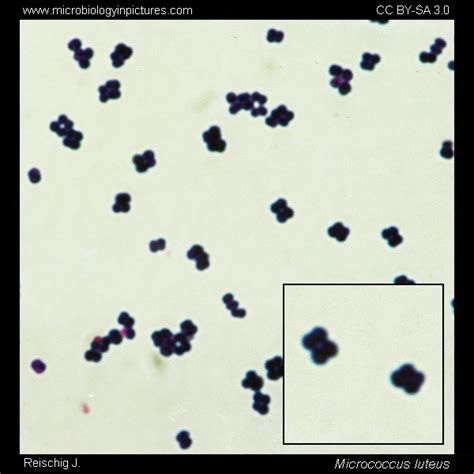 Micrococcus Luteus Gram Stain And Cell Morphology Micrococcus Luteus