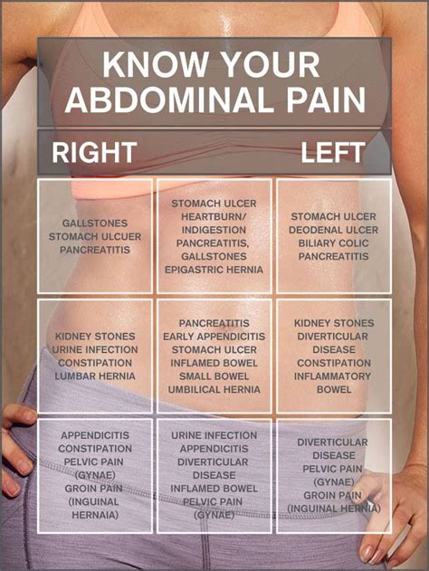 Reference Chart For Abdominal Pain Health And Fitness Pinterest