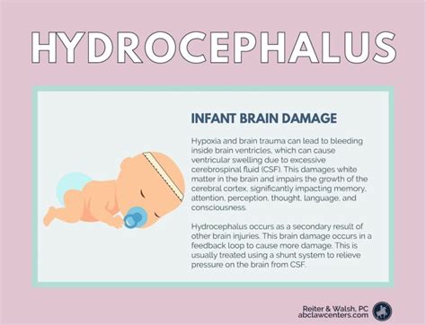 Hydrocephalus Causes And Symptoms Hydrocephalus Lawyer And Attorneys