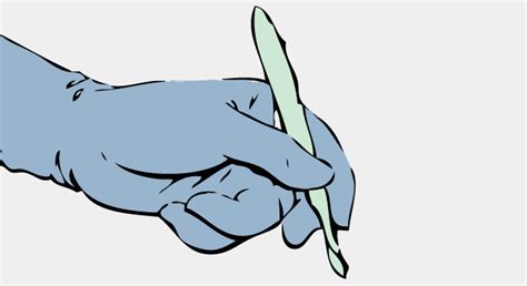 Es gibt eine sanfte entfernung. Myom der Gebärmutter, Uterusmyom