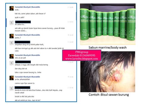 Testimoni 1 (perkongsian sister zalilah) selamat pg. lactolite: Testimoni Sabun Marine Essence