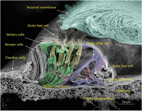 Scanning Electron Microscopy Of The Cochlear Sensory Epithelium Organ