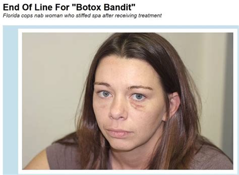 Kelsia The Botox Bandit