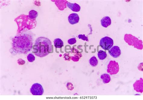 Mesothelial Cell Pleural Fluid Stock Photo Edit Now 652971073