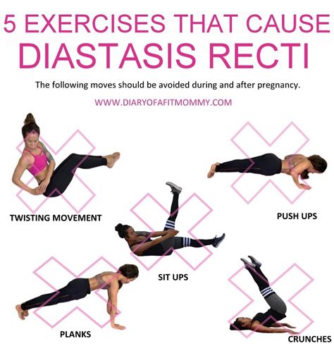 Can I Exercise With Diastasis Recti Exercise Poster