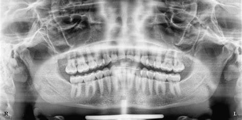 Digital Dental Radiography