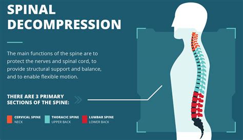 Spinal Decompression Therapy Infographic