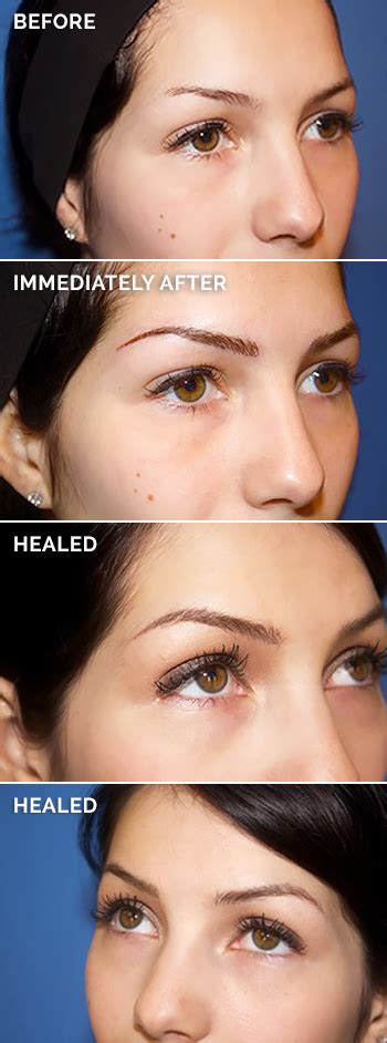 Permanent Makeup Eyebrows Before After And Healed Bios Pics